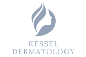 Kessel